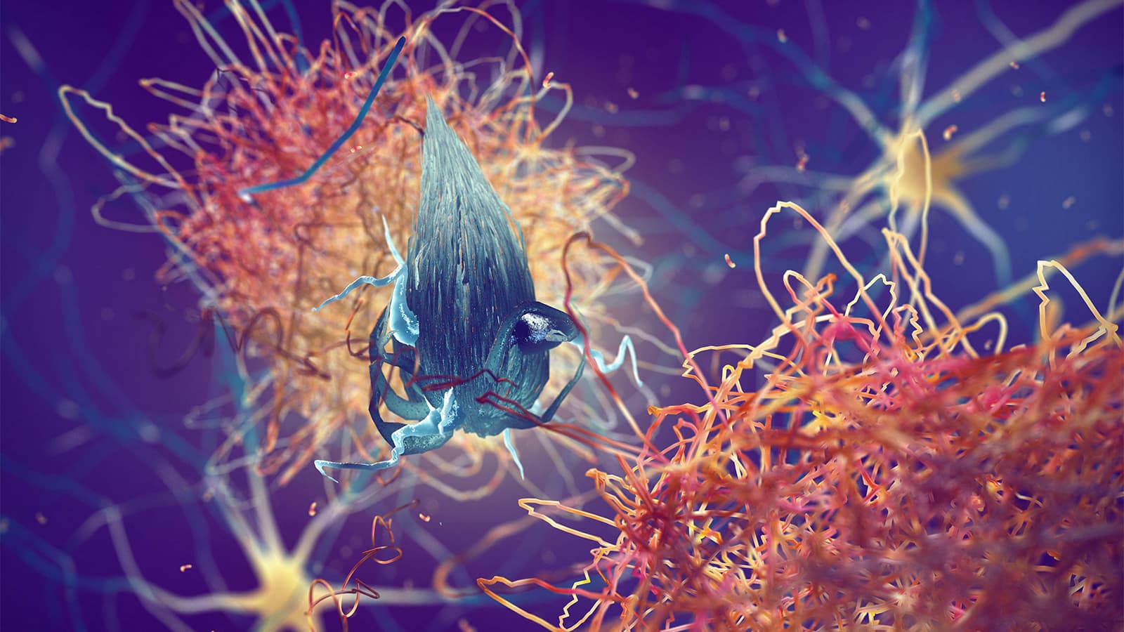 Midlife Vitamin D Levels Tied to Alzheimer's-Related Brain Changes