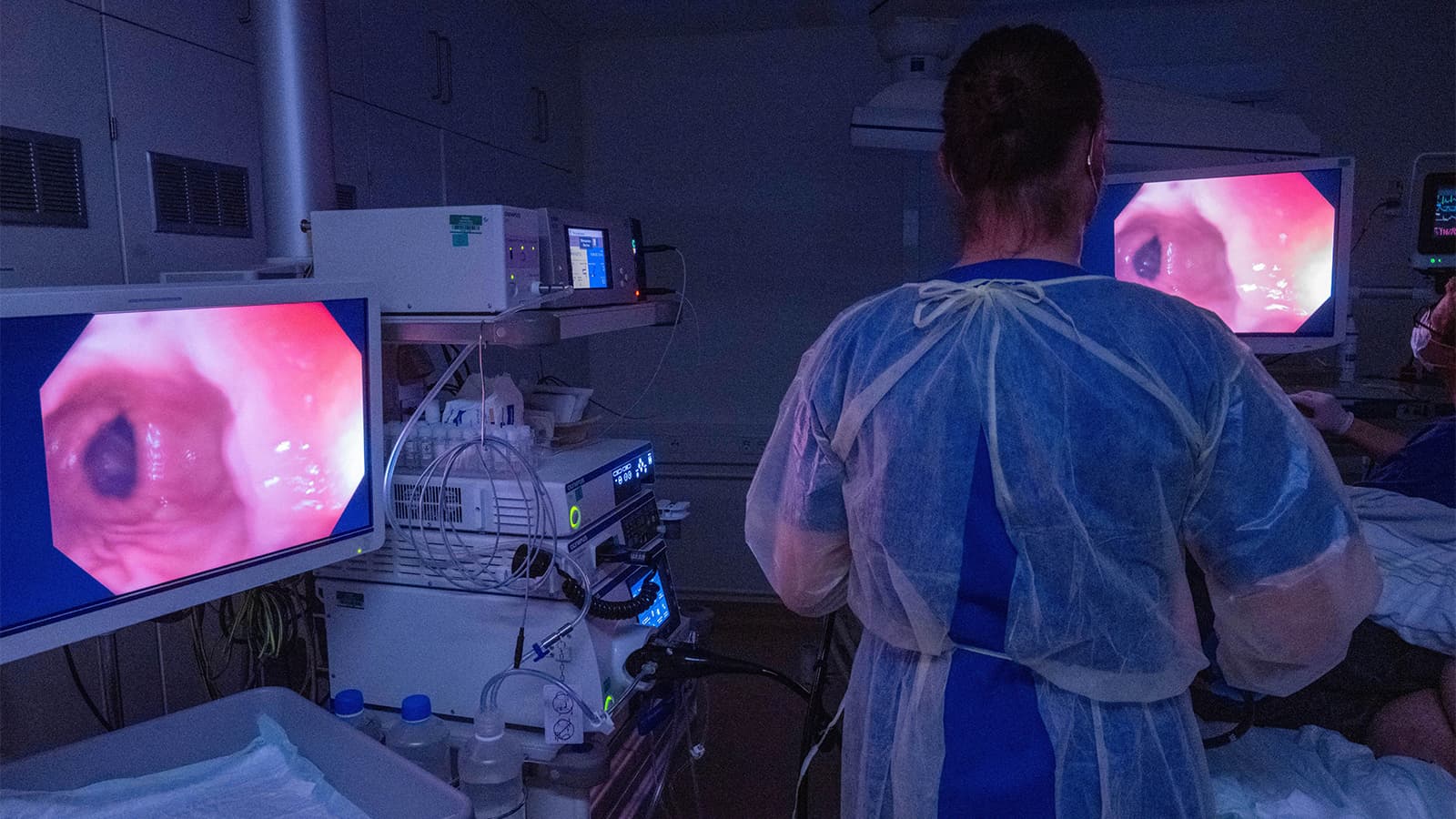 Is Surveillance Colonoscopy Needed for Elderly Patients With Adenomas?