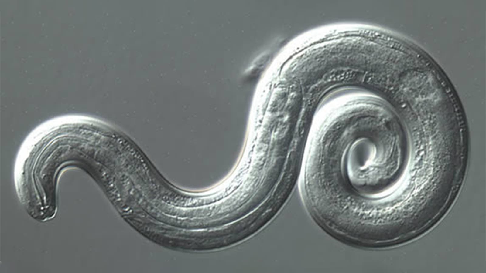 Rat Lungworm Is Now in My State. Is It in Yours Too?