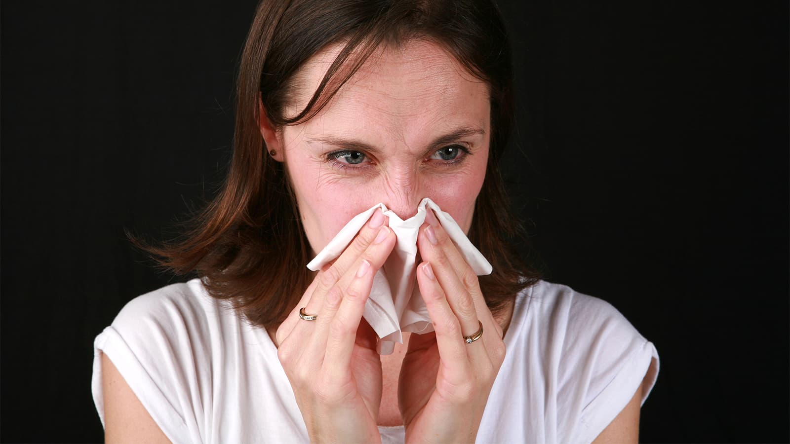 Amoxicillin Alone Holds Up for Acute Sinusitis