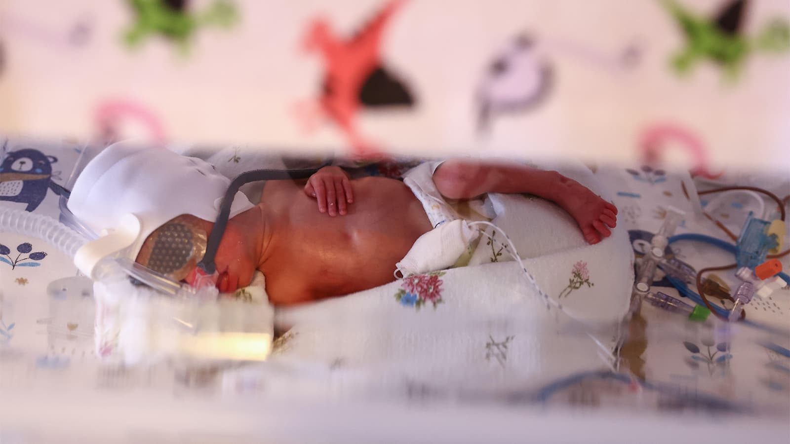 Study on Maternal RSV Vaccine Flags Possible Risk, Calls for More Research