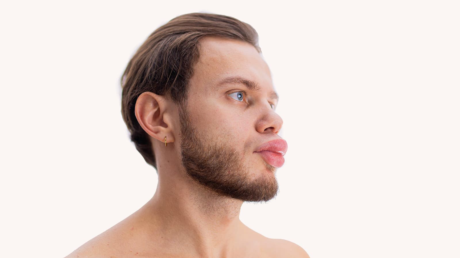 Hereditary Angioedema Prophylaxis: Persistence and Adherence