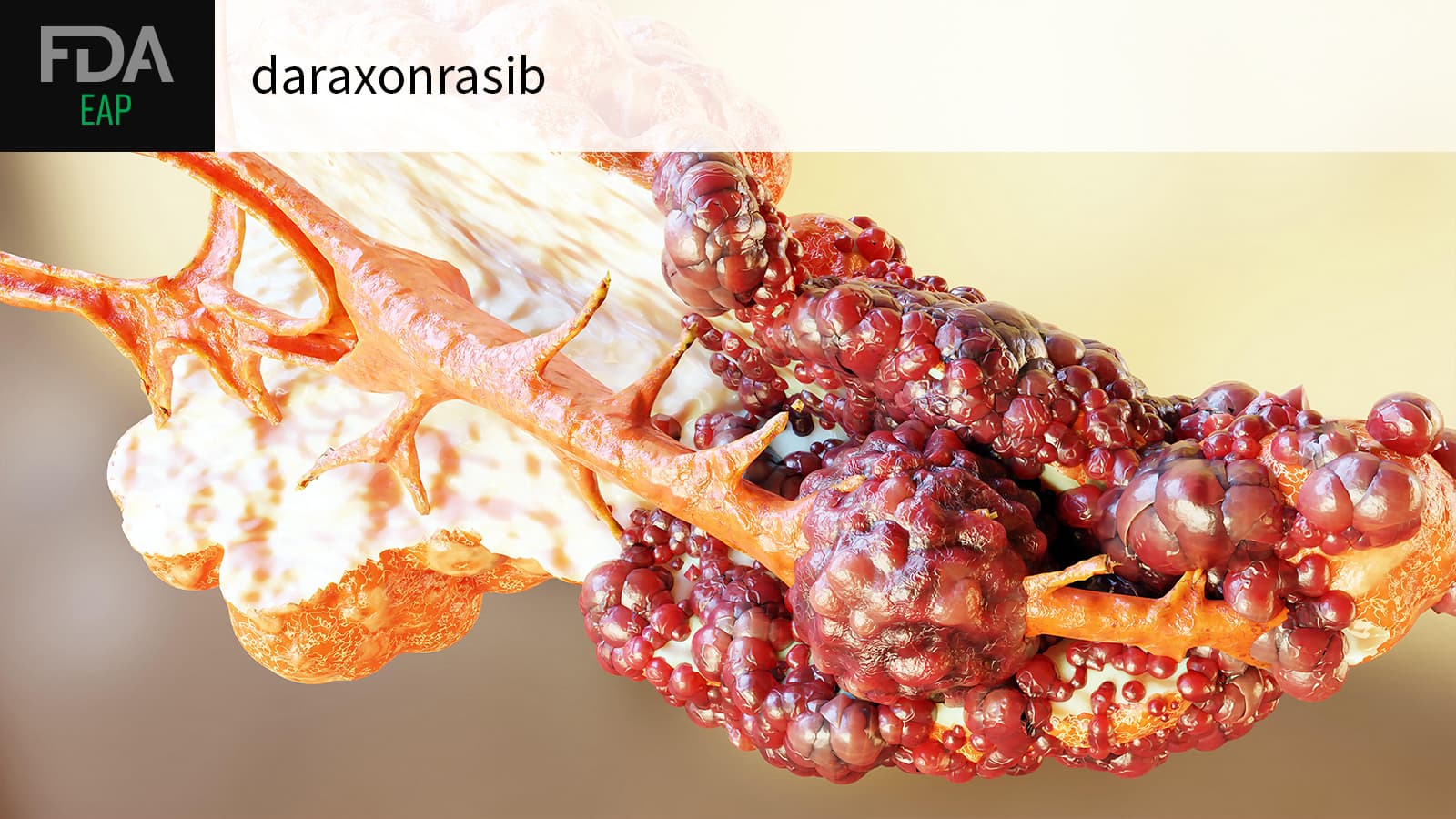 FDA Opens Early Access to Novel Pancreatic Cancer Drug Generating Buzz