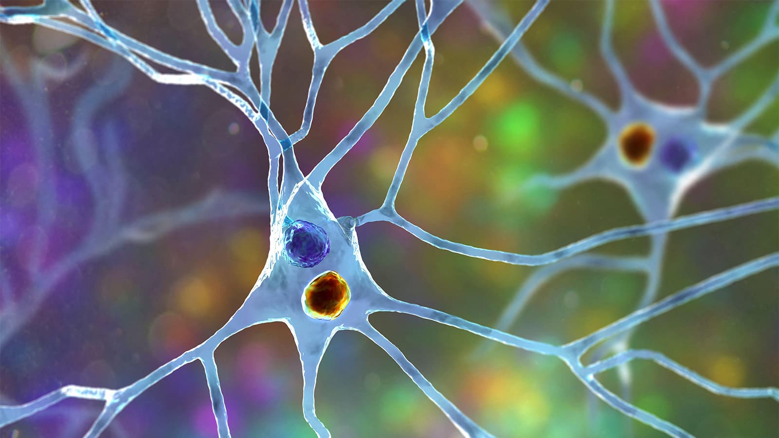 Is Pure Autonomic Failure a Warning Sign for Parkinson's? What a New Study Shows.