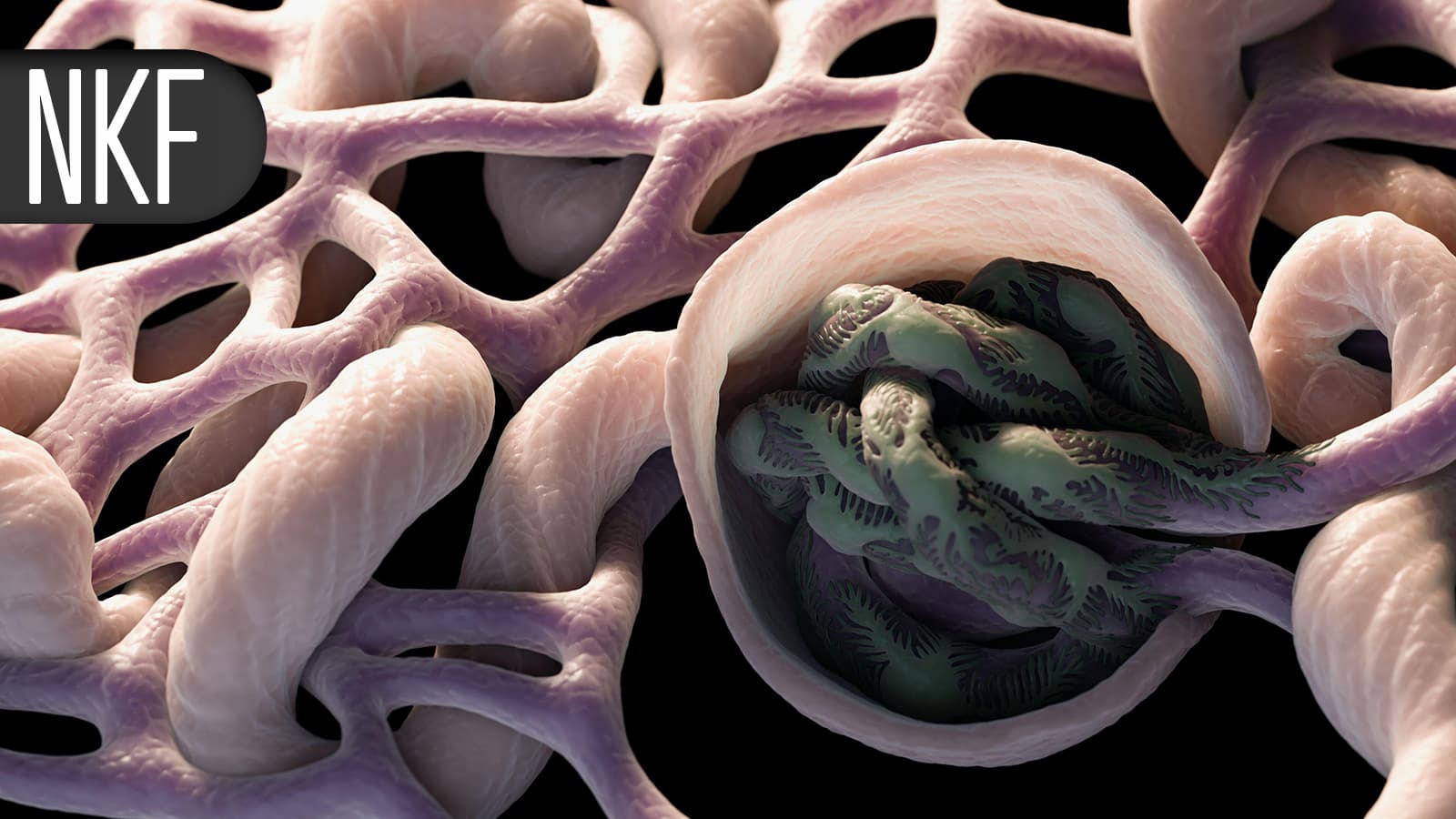 Female Nephrologists Find Barriers to Achieving Goals in Academic Medicine