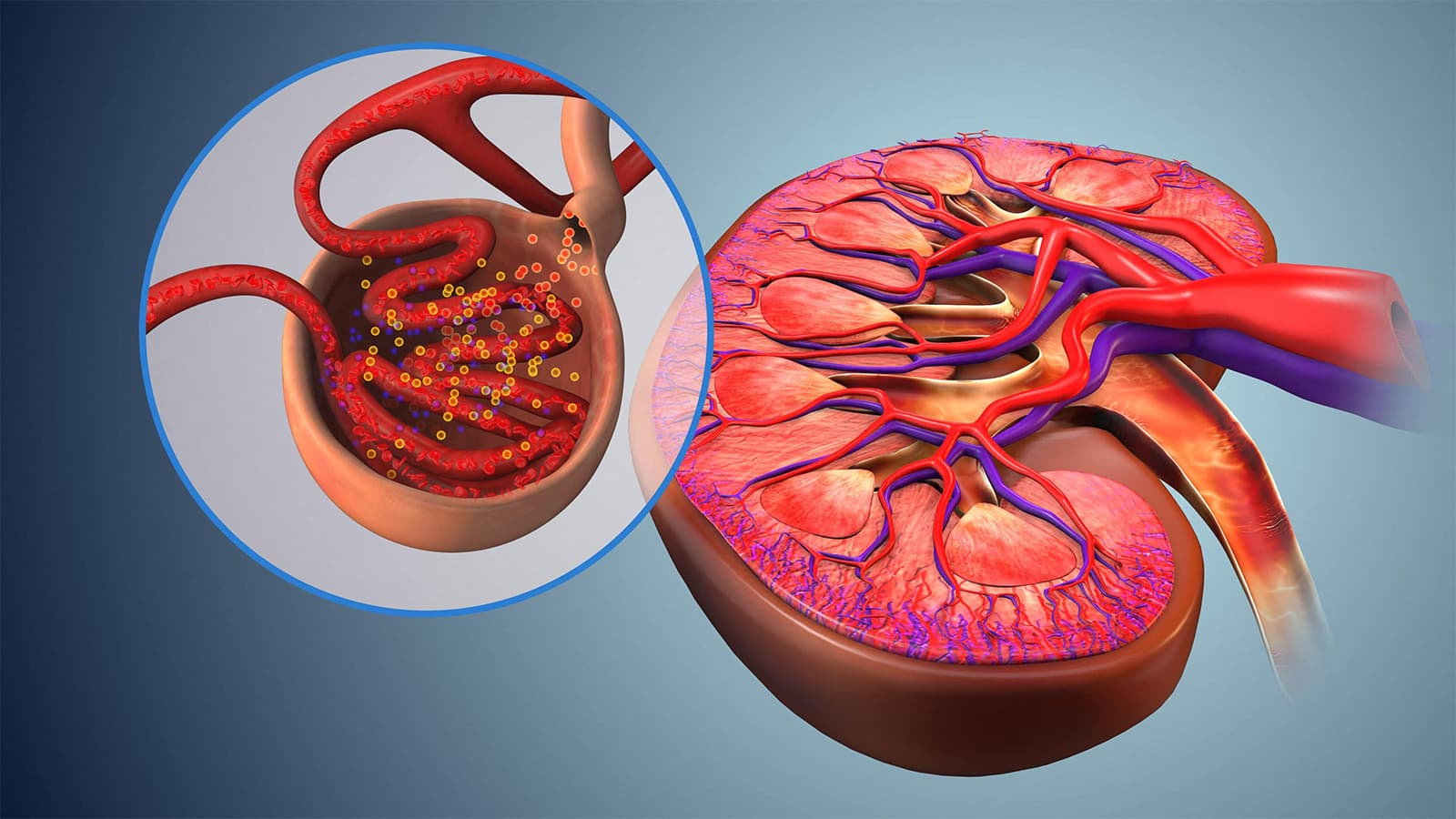 Competition Builds for Novel IgA Nephropathy Approach