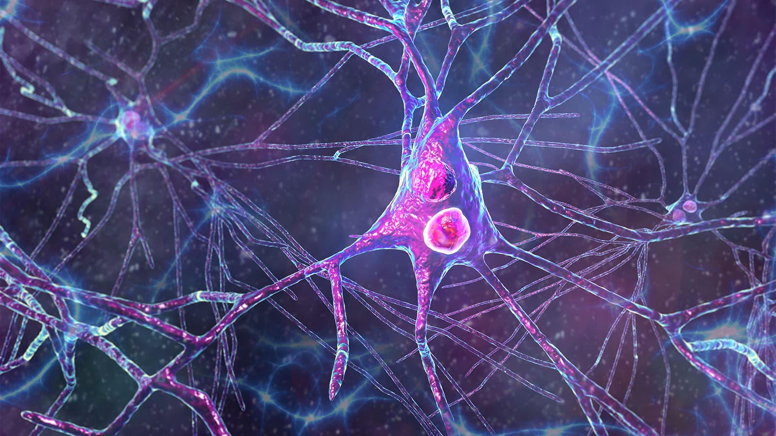 Dementia With Lewy Bodies May Be More Common Than We Think