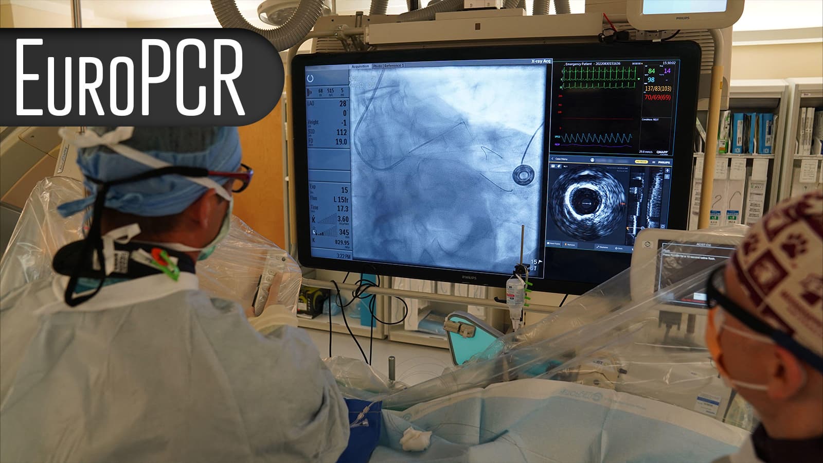 Creeping Gradients After TAVR Linked to Poor Longer-Term Outcomes
