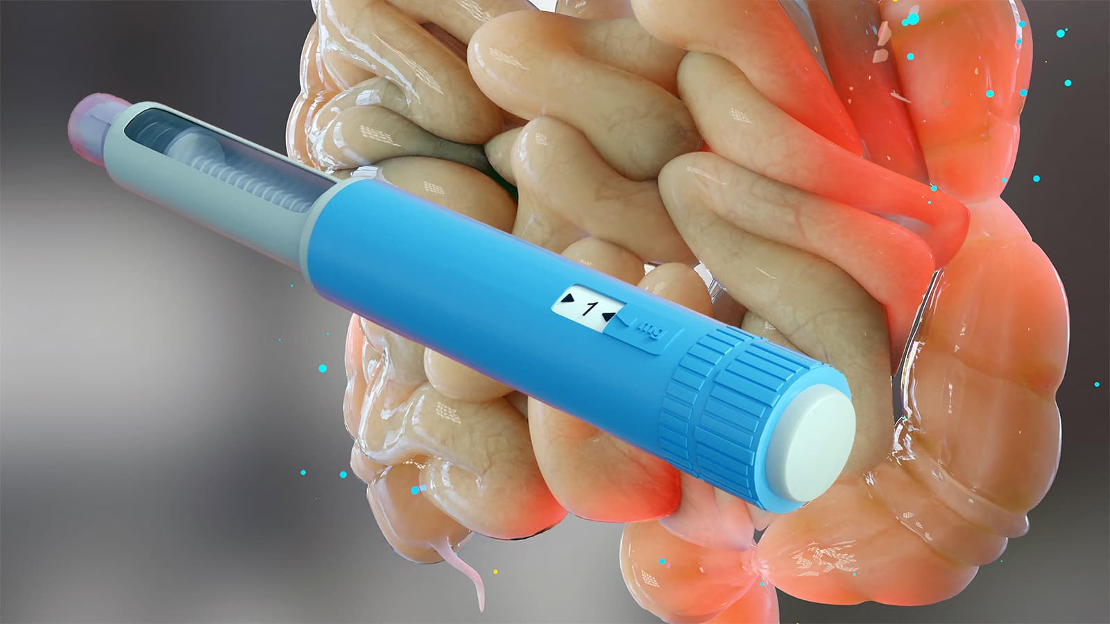 Five Things to Know About Weight-Loss Drugs and IBD