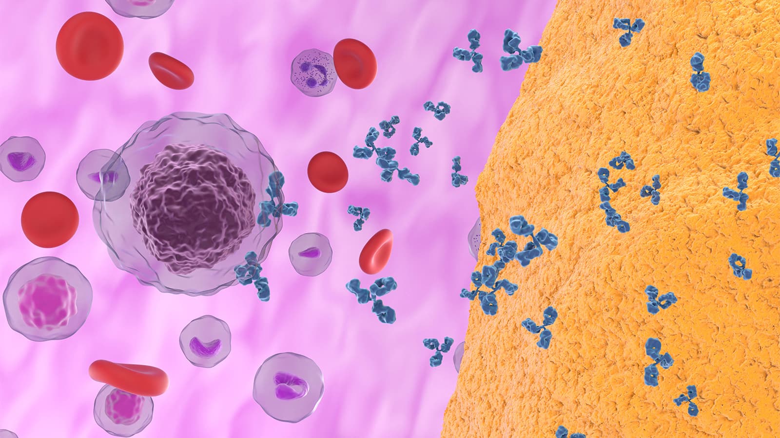 Serology Affects Transition From Arthralgia to Full-Blown Rheumatoid Arthritis