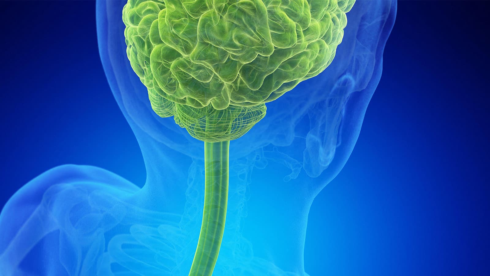 No Difference in Complications for Chiari I Surgical Approaches in Kids, Study Shows