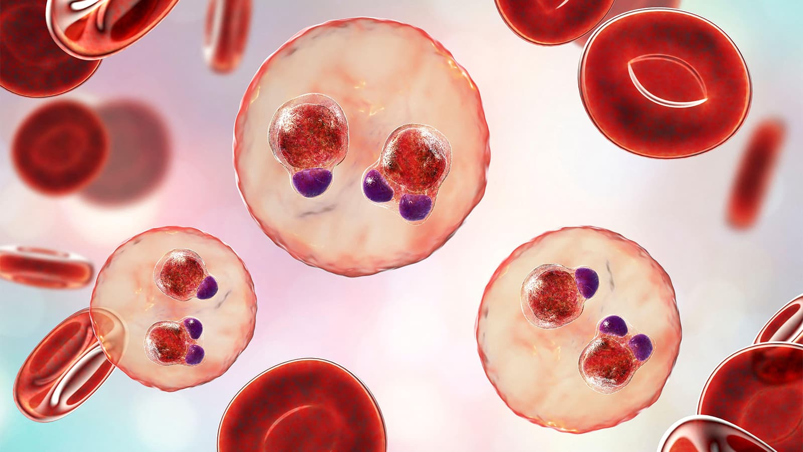 Standard Malaria Treatment Effective, Even Amid Drug-Resistant Gene Variants