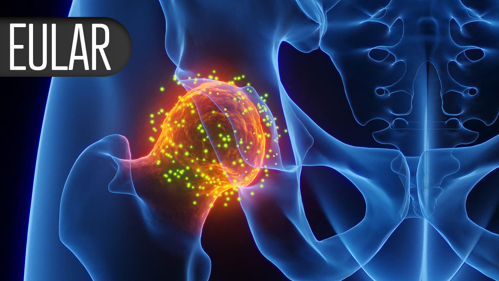 How Much Prednisone Is Too Much in Treating Rheum Effects From Cancer Therapies?