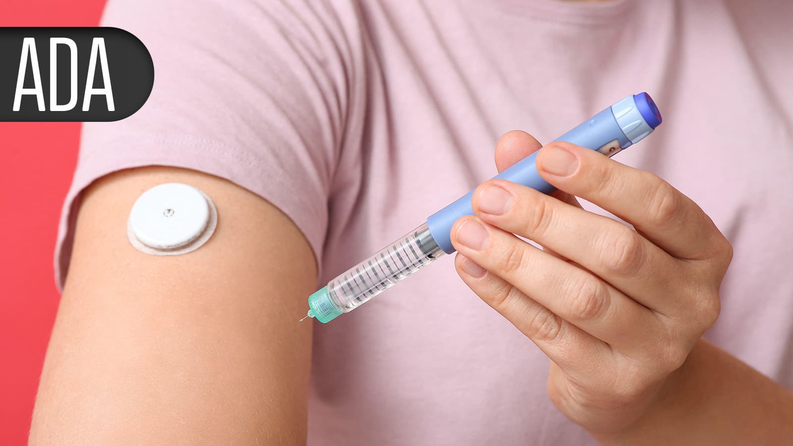 Up to 40% of Diabetes Patients Achieved Normal HbA1c With Retatrutide