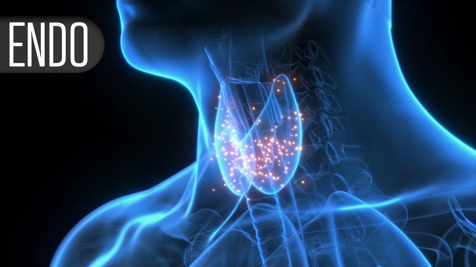 Endocrine Society Issues First Guideline on Central Precocious Puberty