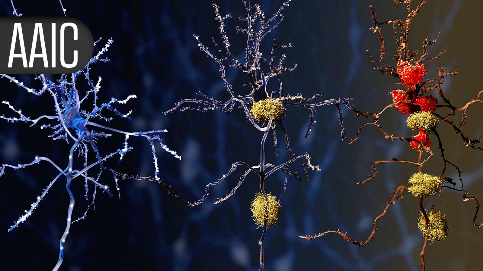 Lifestyle Changes May Slow Brain Aging in Adults Younger Than 70