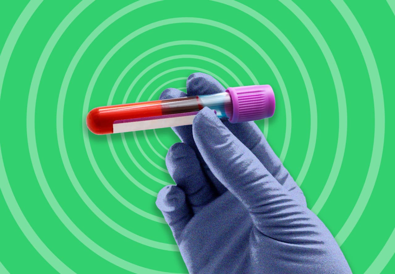 A new blood test can help detect colon cancer, but it’s not as good as the test you hate to take