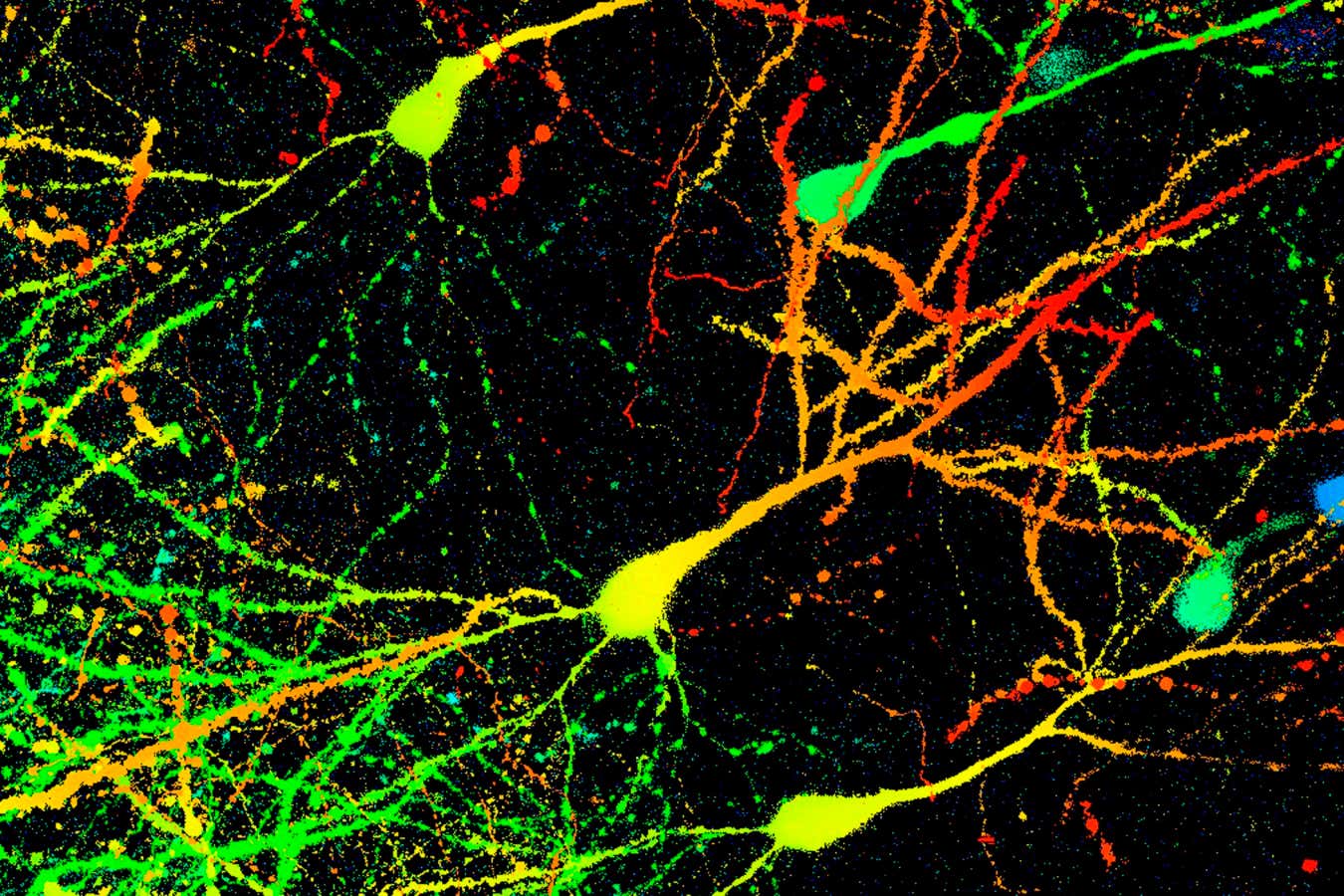 Mysterious 'compound X' clears toxic Parkinson’s proteins from brain