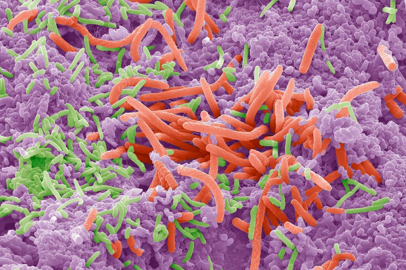 Your oral microbiome could affect your weight, liver and diabetes risk