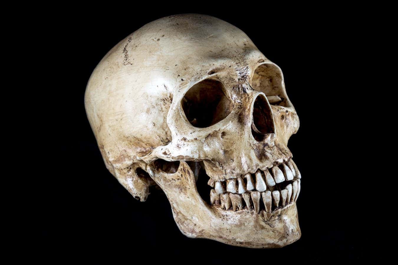 Human heads have changed shape a lot in the past 100 years