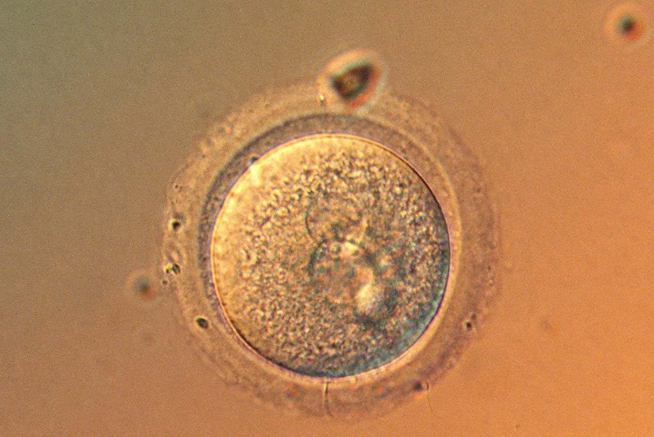 Are we getting to the point where it's safe to gene-edit babies?