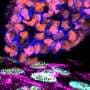 How invading cancer cells grip and rip their way into new tissues