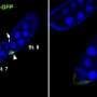 Extra sets of chromosomes may help aggressive tumor cells spread, study finds