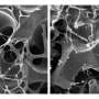 Graphene 'scaffold' recruits bone cells and helps the body regenerate fractures