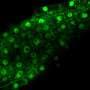 Plants under stress switch from photosynthesis to protein cleanup, researchers show