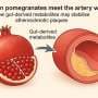 Saturday Citations: Cruise ship pathogen spread in ancient Rome; Plus: Pomegranates, retinal implants