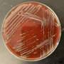 Q&A: Why scientists are studying a microbe they found in a sink