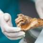 Ötzi the Iceman and his microbiome—a 5,300-year-old relationship