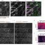 Understanding the mechanisms of collective cell movement