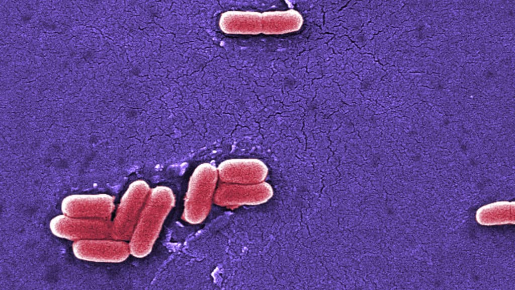 Raw dairy co. refutes connection to E. coli outbreak