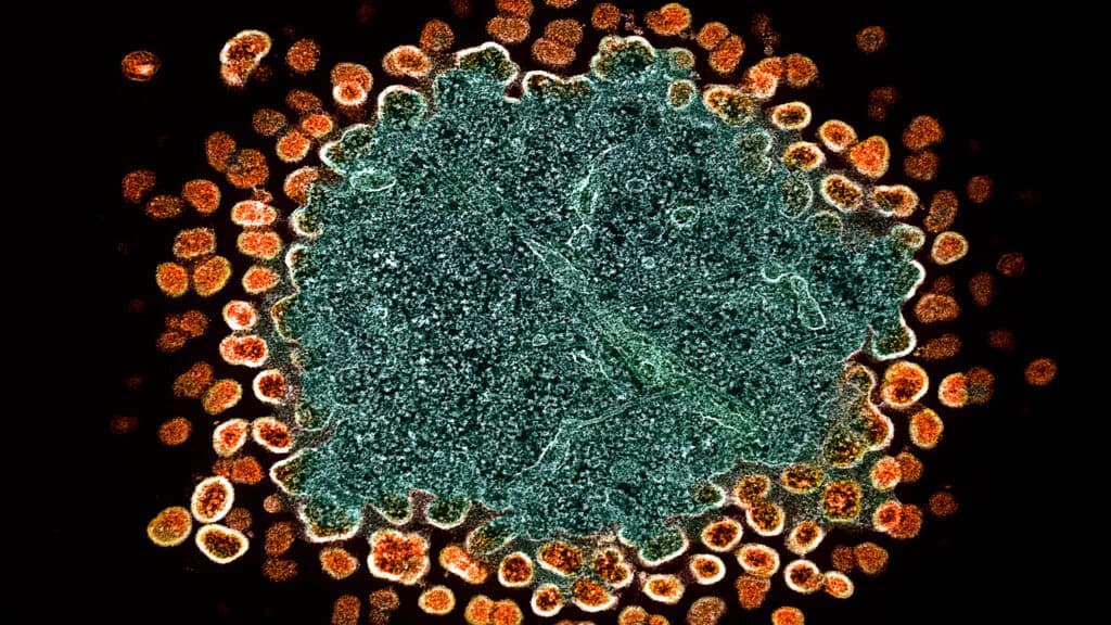 Scientists uncover a new hiding spot for HIV