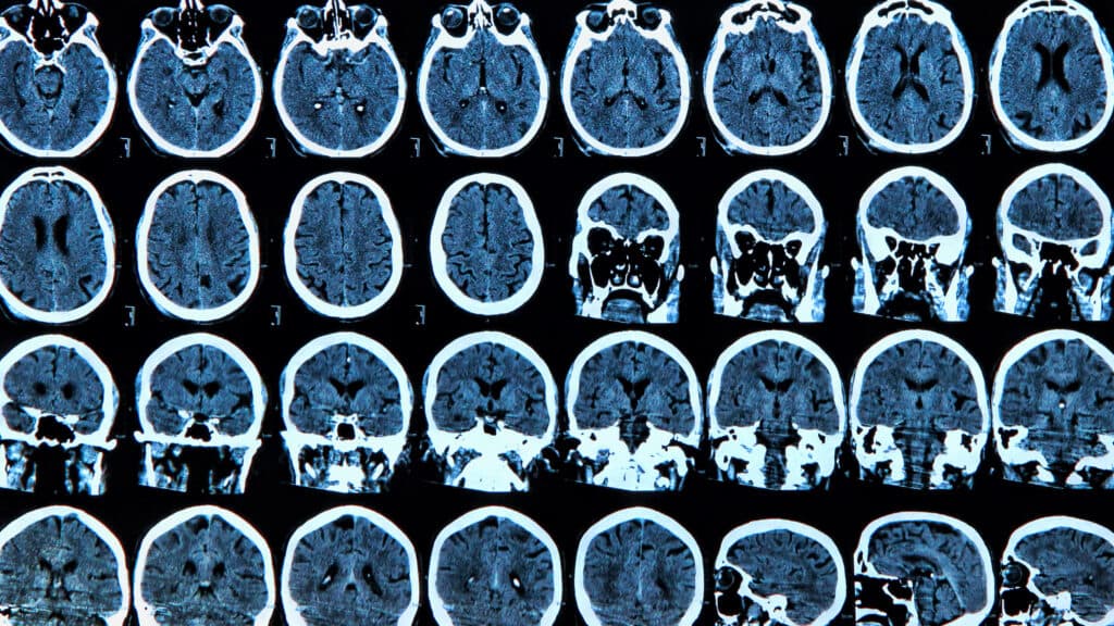 Opinion: What happens when a chief executive loses executive functions?