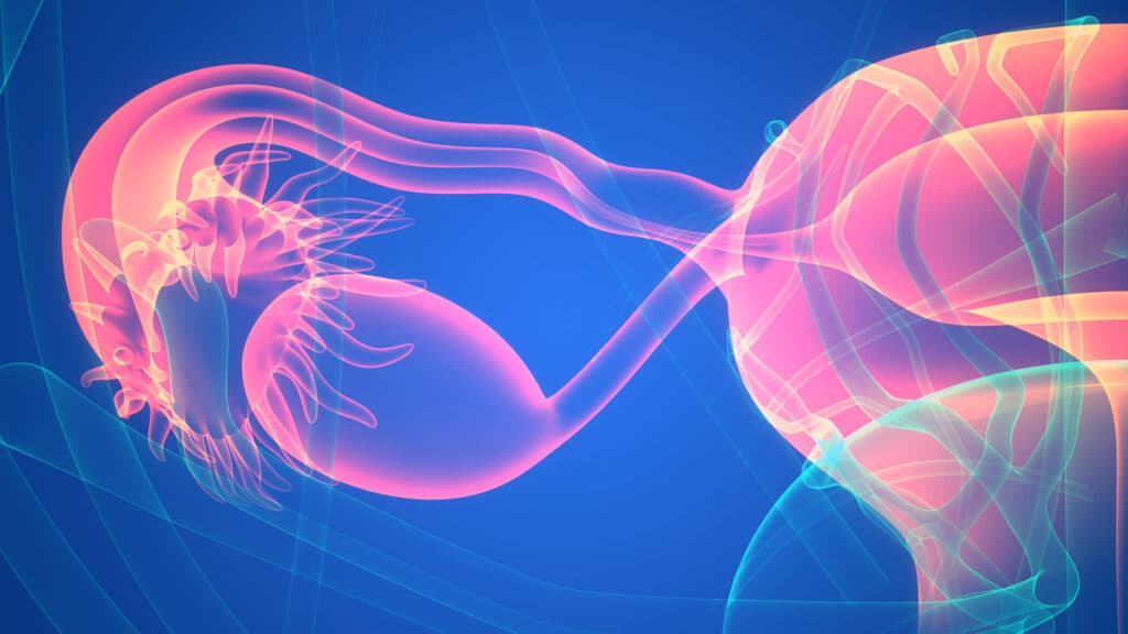 PCOS’s new name is PMOS, a small letter change that required a big scientific process