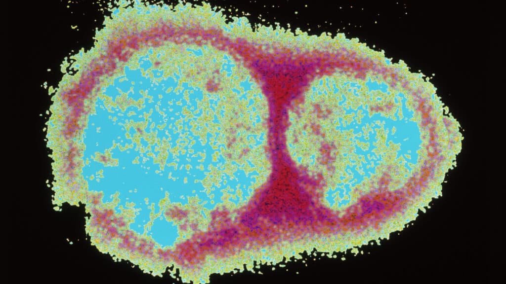 Opinion: I’m fighting misinformation online. False hantavirus claims follow a now-familiar playbook