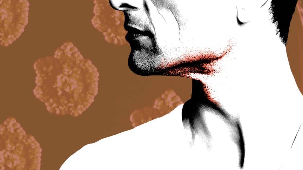 Animal skin disease confirmed in clusters of European men who have sex with men