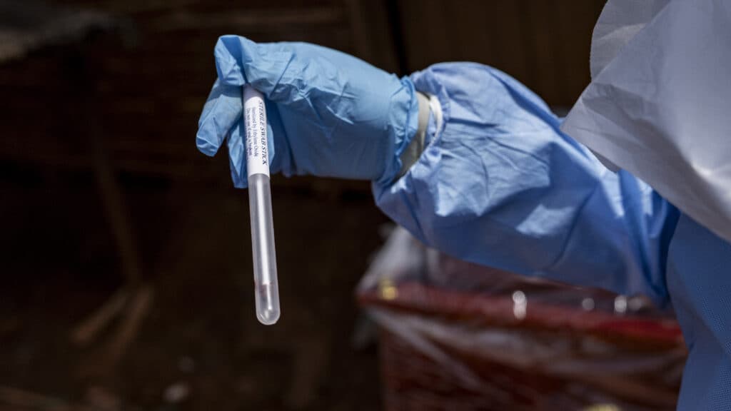 HHS confirms Americans with high-risk Ebola exposures will have access to experimental therapy