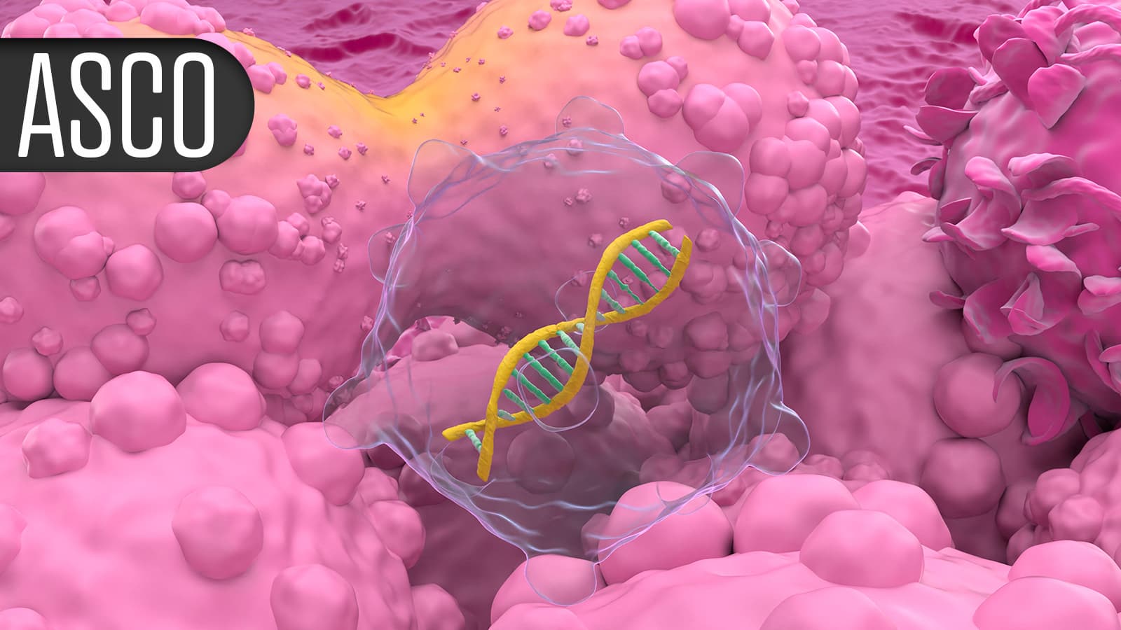 GLP-1s Linked to Lower Risk of Cancer Spread in Four Tumor Types