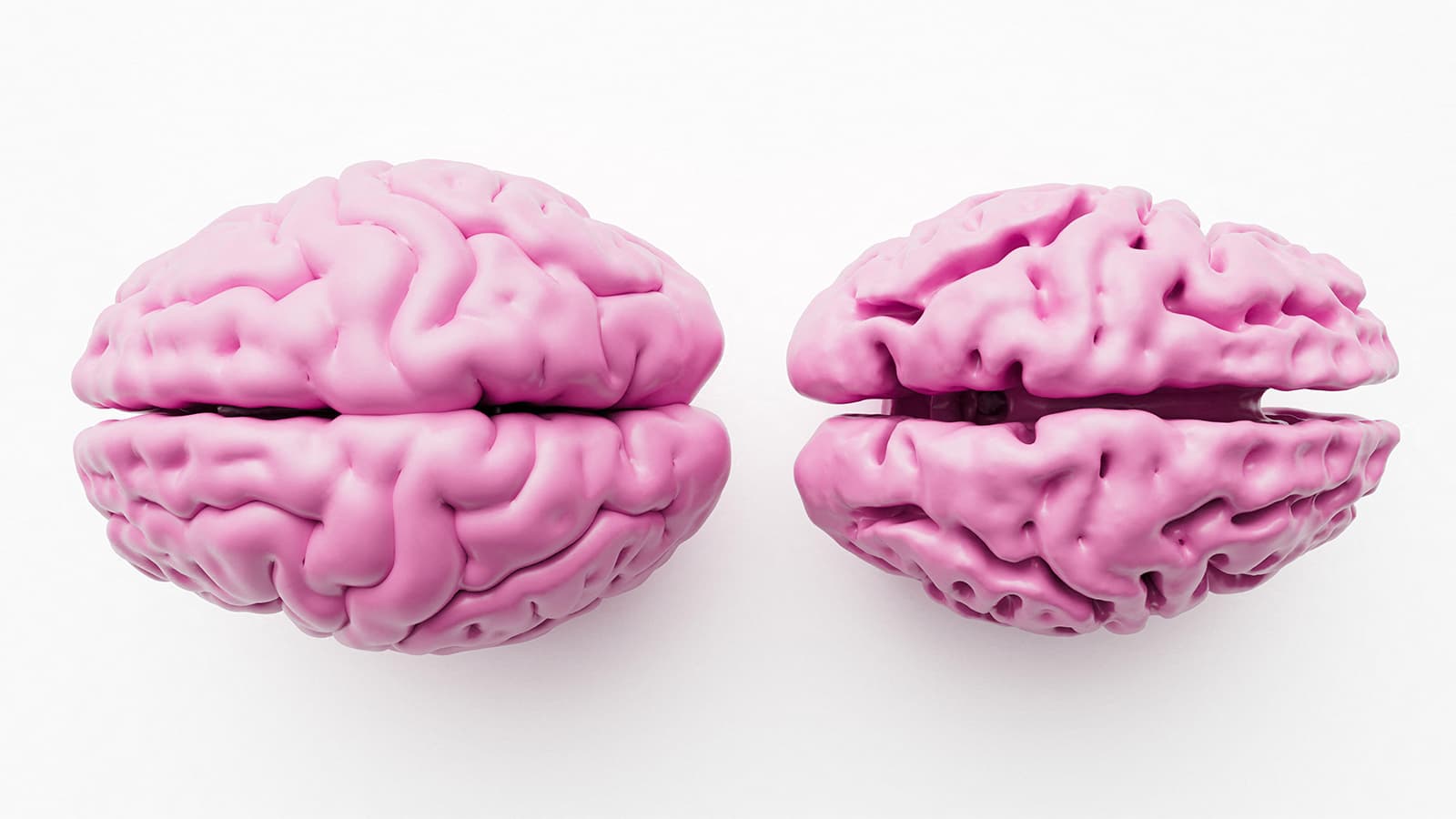 A 'Youthful' Brain May Boost Alzheimer's Resilience
