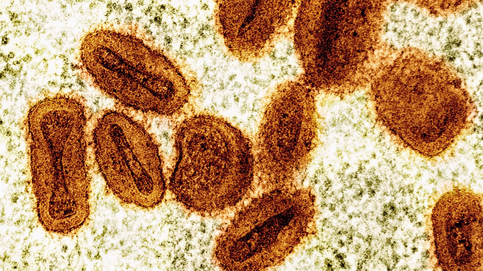 Scientists Charged With Bringing Deactivated Mpox Into U.S., Lying to Authorities
