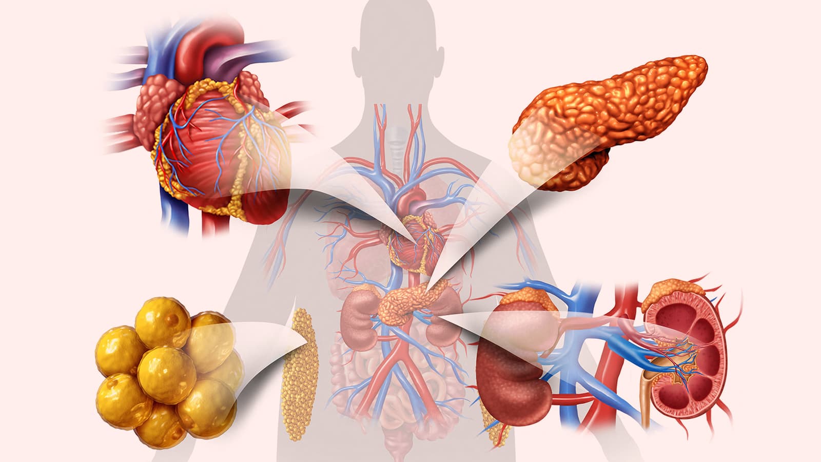 First Guideline on Cardiovascular-Kidney-Metabolic Syndrome Released