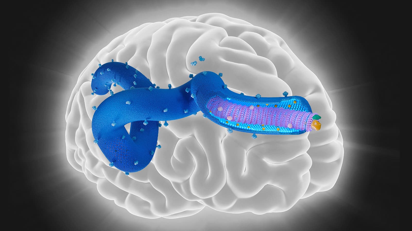 Ebola's Brain Effects Persist More Than 7 Years After Infection
