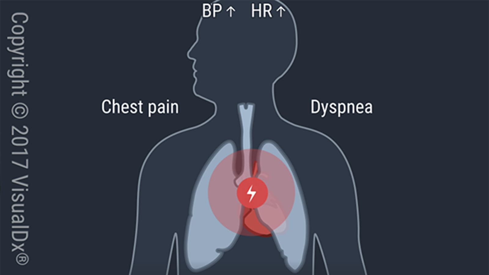Make the Diagnosis: Chest Pain, Dyspnea, Palpitations, and More: What’s Her Diagnosis?