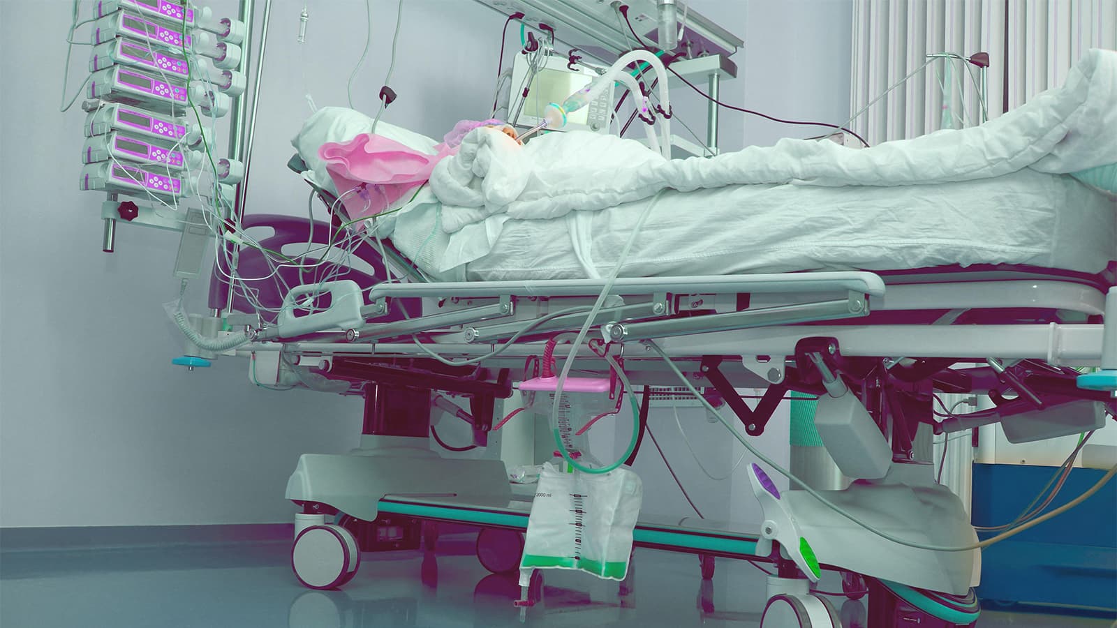 Sodium Bicarbonate Fails to Improve Kidney Outcomes in ICU