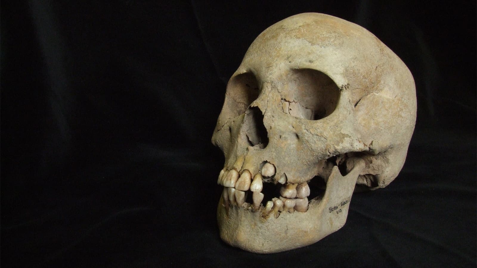 Ancient Teeth Push the Plague's Timeline Back to Over 5,500 Years Ago