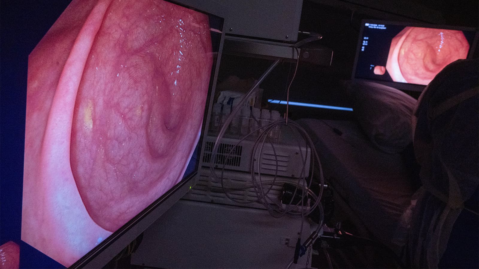 After Positive Fecal Test, Here's What Gets Patients to Colonoscopy