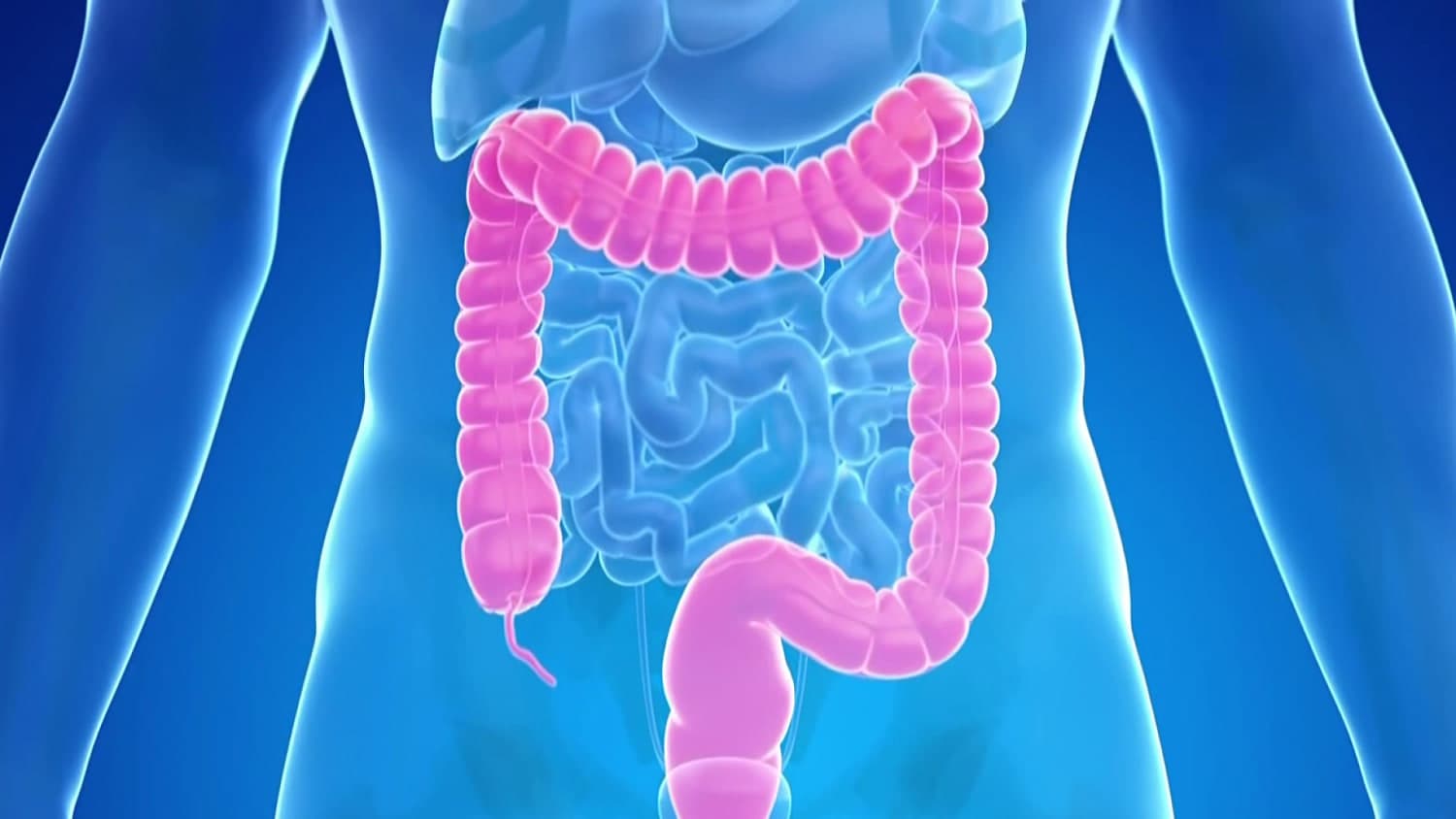 New blood test is added an an option for colorectal cancer screenings